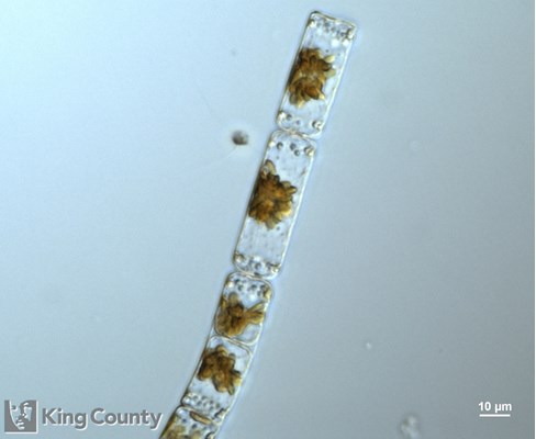 Photo of Cerataulina pelagica